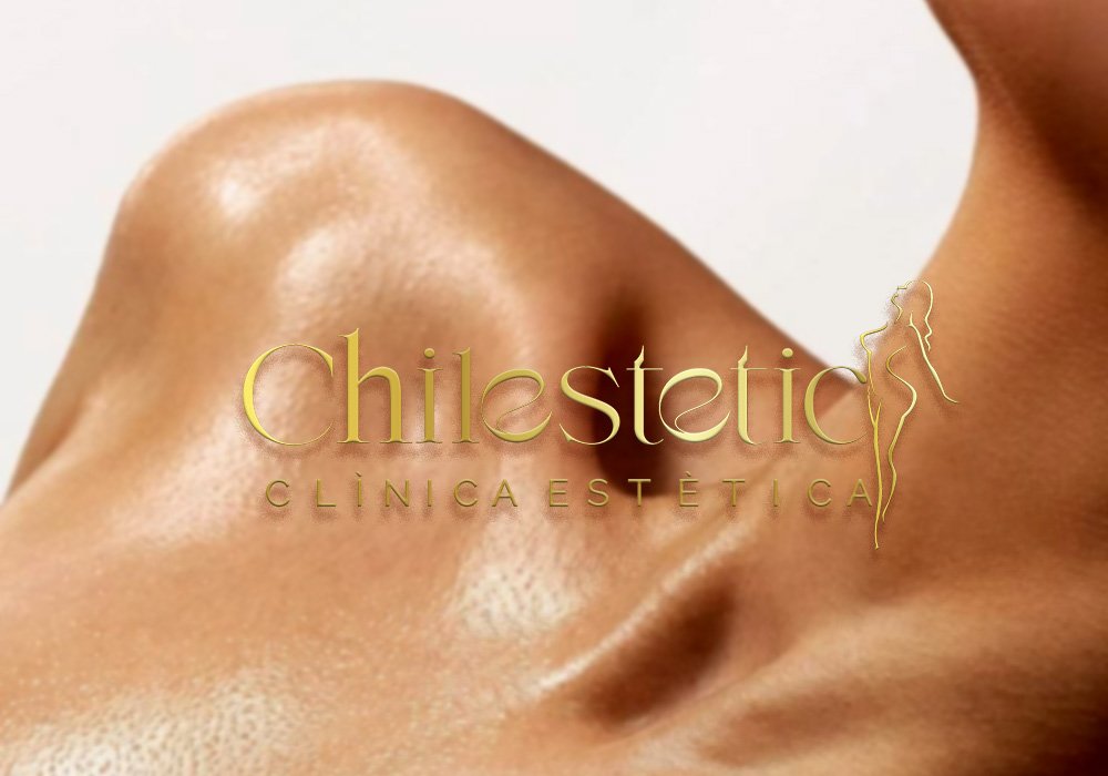 Clínica Chilestetic — sala de procedimientos